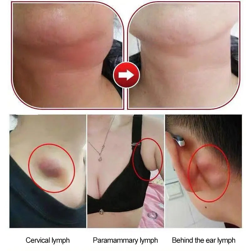 Lymphatic health stickers neck drainage patches in white colour pack of 10 for overnight detox and immunity