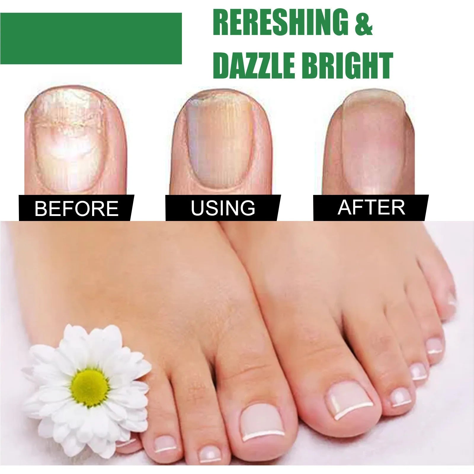 30ml tea tree oil nail repair treatment bottle for thick nail and cuticle care