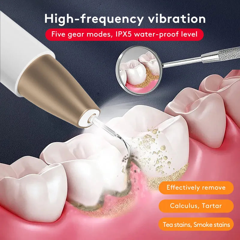 Gold coloured ultrasonic tooth cleaning device for removing tartar and stains.