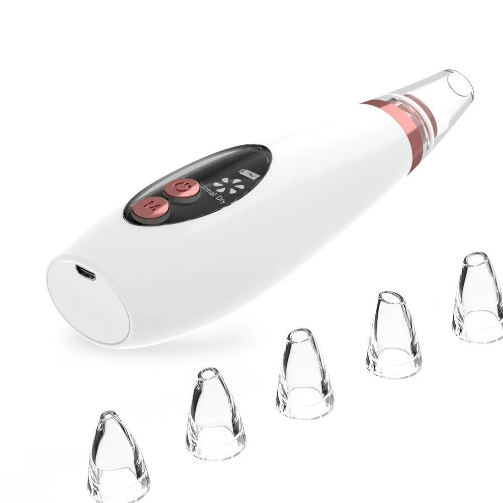 White blackhead pore vacuum cleaner with microcrystalline tip for nose and face cleansing, USB rechargeable