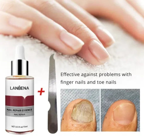Nail repair essence 12ml bottle with salicylic acid for nail grooves and care
