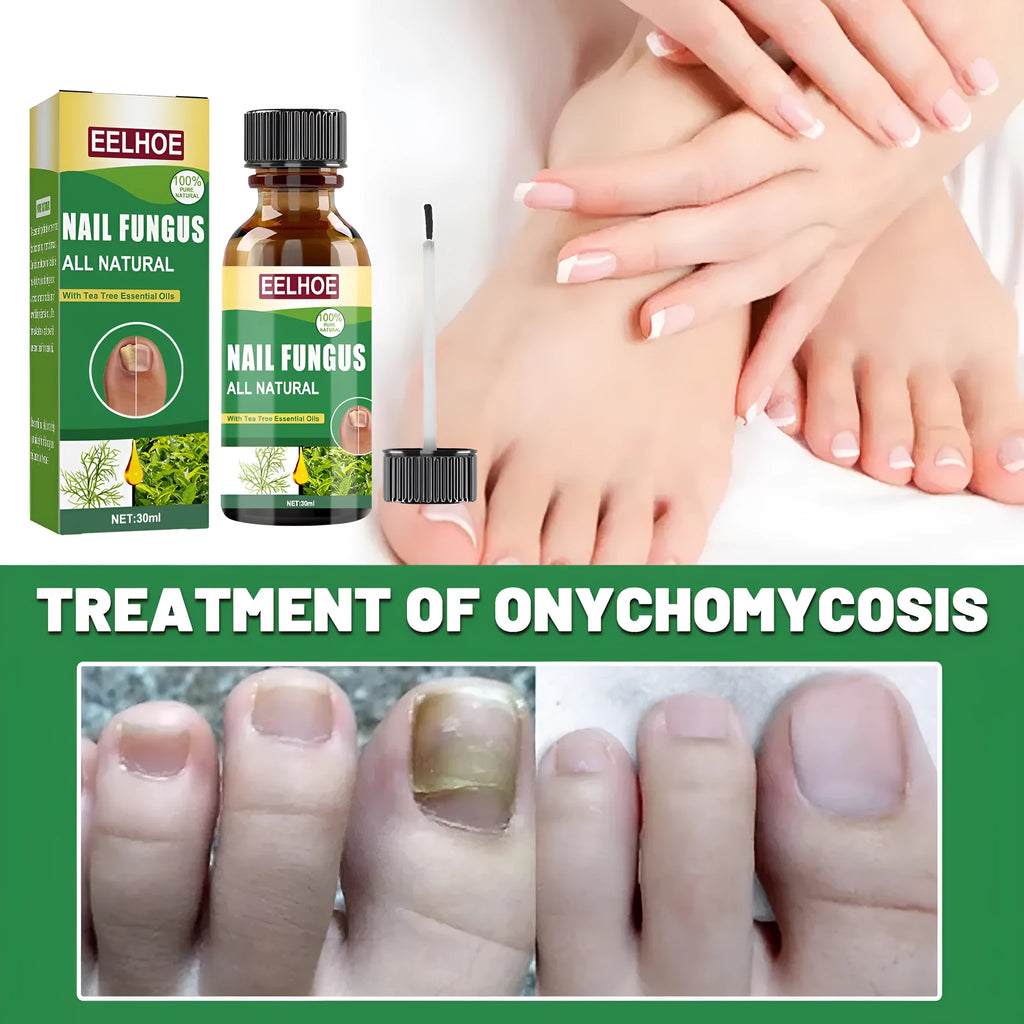 30ml tea tree oil nail repair treatment bottle for thick nail and cuticle care