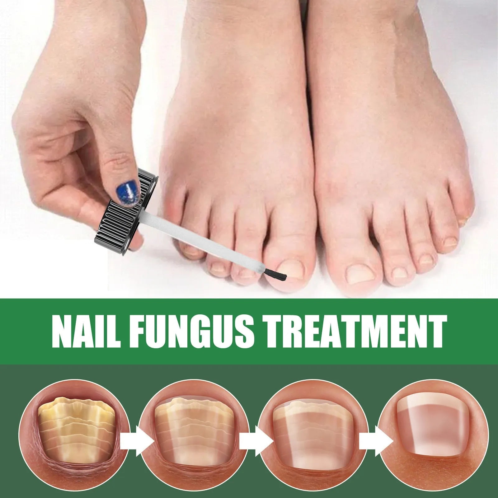30ml tea tree oil nail repair treatment bottle for thick nail and cuticle care