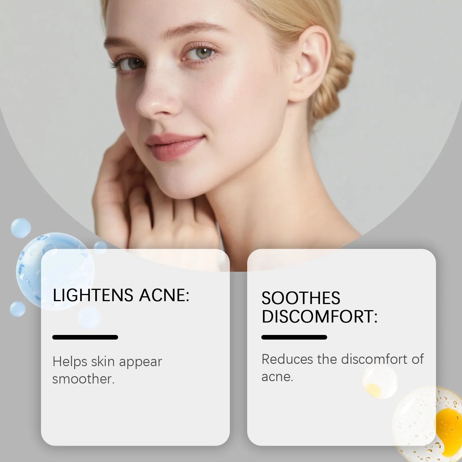 Pack of 80 transparent hydrocolloid acne patches for facial spot treatment.