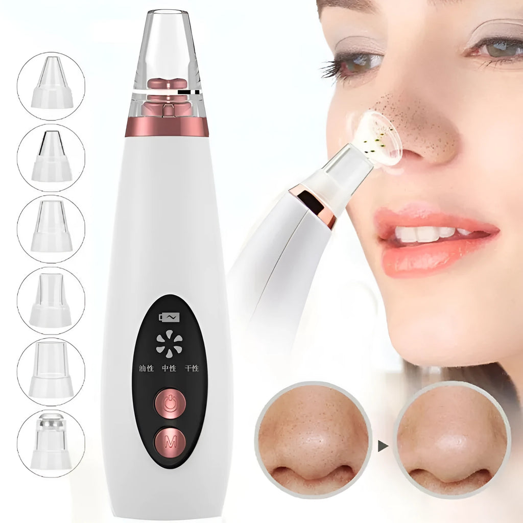 White blackhead pore vacuum cleaner with microcrystalline tip for nose and face cleansing, USB rechargeable
