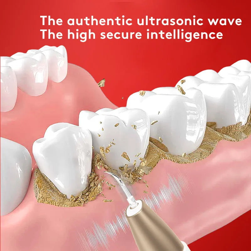 Gold coloured ultrasonic tooth cleaning device for removing tartar and stains.